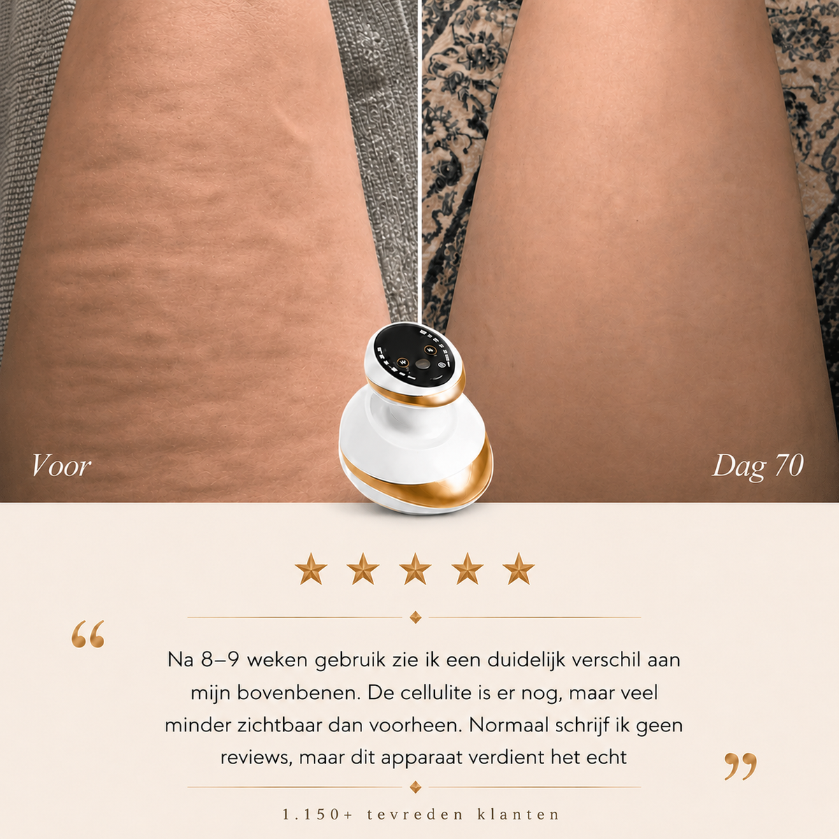 Celluxe™ - Anti-cellulite