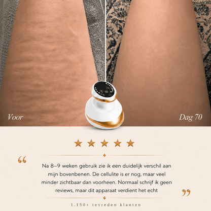 Celluxe™ - Anti-cellulite