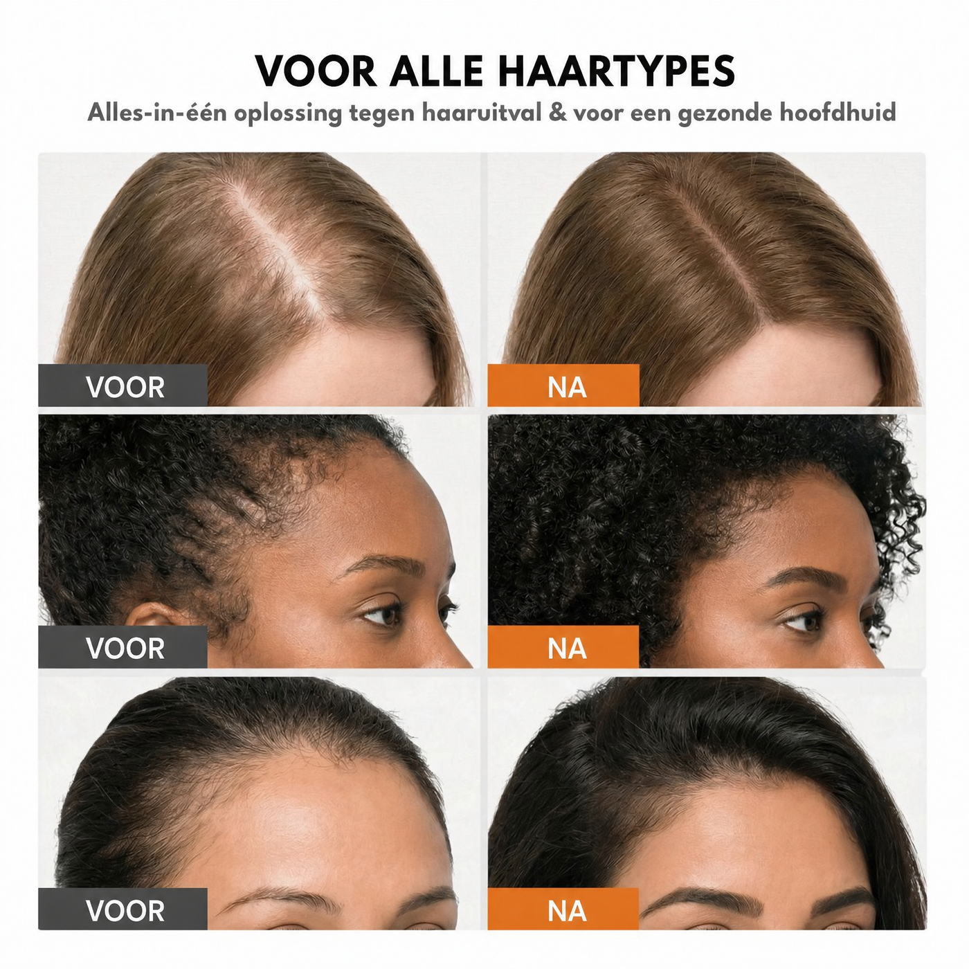 Voor alle haartypes