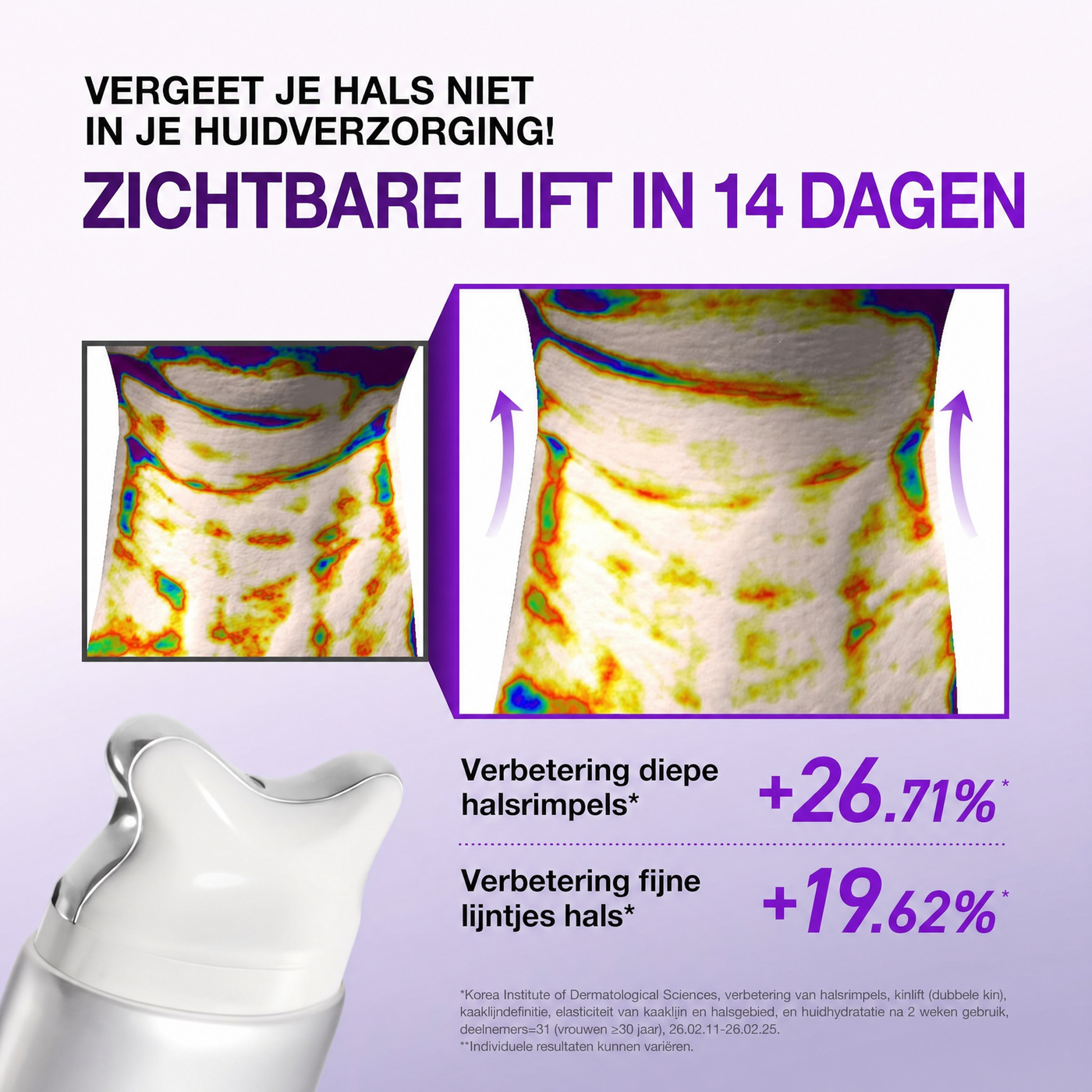 Zichtbare lift in 14 dagen
