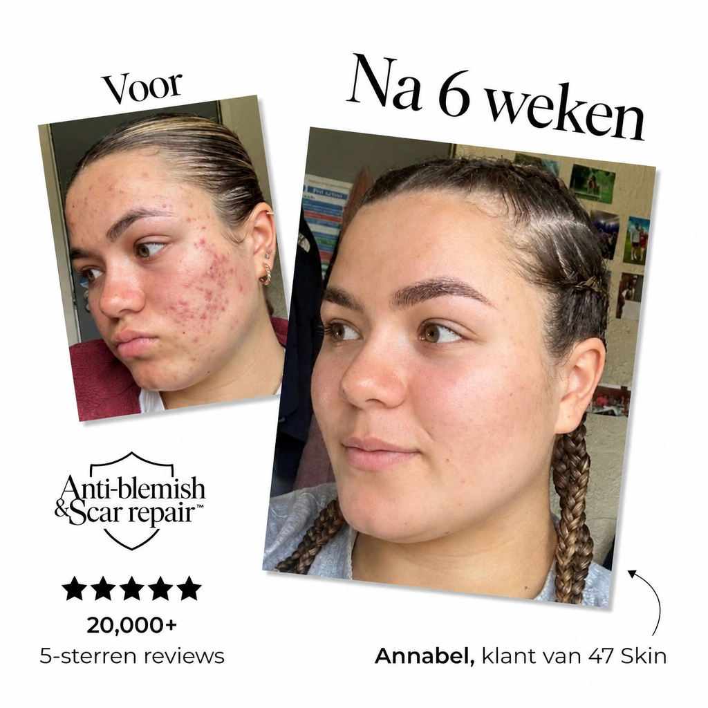 Voor en na - Annabel, 6 weken